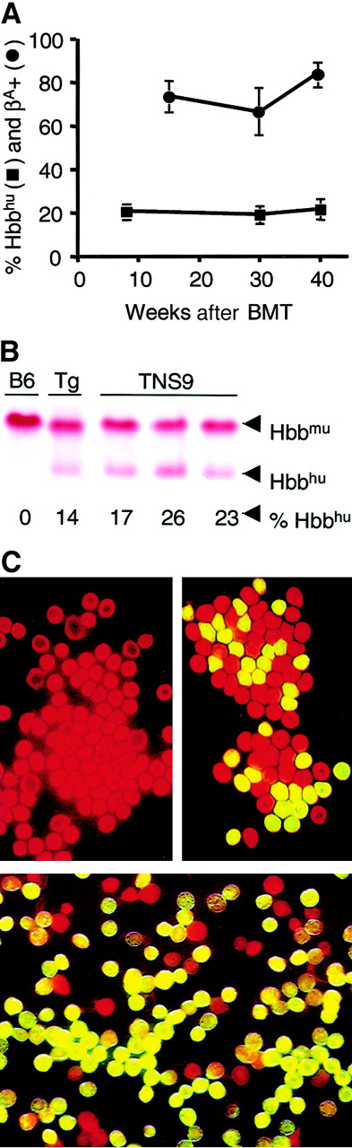 Fig. 1. Sustained production of human β-globin protein (βA) in the peripheral blood of TNS9-transduced bone marrow chimeras. / (A) The percent of hemoglobin tetramers that incorporate βA, termed Hbbhu (filled squares), and the percent of peripheral RBCs that stain positive for βAchain (filled circles) remained stable up to 40 weeks after BMT. (B) Cellulose acetate gel electrophoresis shows Hbbhu levels in 3 TNS9-transduced bone marrow chimeras (TNS9) 40 weeks after transplantation. Control lanes contain normal C57BL/6 (B6) and transgenic mouse line A85.68 (Tg28) blood samples. The fraction of Hbbhu relative to total hemoglobin (Hbbhu/Hbbhu + Hbbmu) is indicated below each sample. (C) Peripheral blood erythrocytes from TNS9-transduced bone marrow chimeras were stained for TER-119 (red) and βA (green, becoming yellow when superimposed on the red signal), then analyzed under an immunofluorescence microscope. Upper left panel shows normal C57BL/6 RBCs; upper right panel shows 50:50 mix of RBCs from normal C57BL/6 and A85.68 mice; lower panel is a representative blood sample from a TNS9-treated bone marrow chimera analyzed 40 weeks after transplantation. Original magnification × 40.