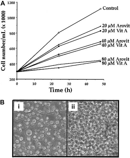 Fig. 2. Effect of Arovit and vitamin A on the growth of K-562 cells. / (A) K-562 cells were plated at 300 000 cells/mL and incubated with or without different Arovit or vitamin A amounts. At the reported time intervals, the cell number was determined. The data shown represent the mean of 3 independent experiments, each performed in duplicate. (B) Morphologic appearance of K-562 incubated for 48 hours with (i) or without (ii) 80 μM vitamin A.