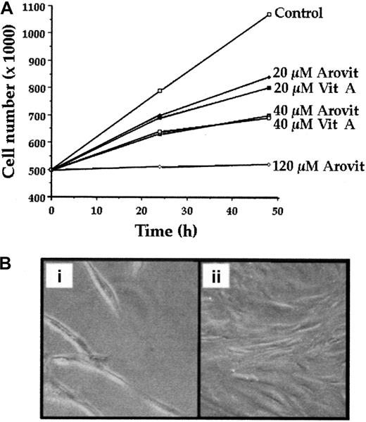 Fig. 3. Effect of Arovit and vitamin A on the growth of MSCs. / (A) MSCs were plated at a density of 5 × 103cells/cm−2 and incubated with or without different Arovit or vitamin A amounts. At the reported time intervals, the cell number was determined. The data shown represent the mean of 3 independent experiments, each performed in duplicate. (B) Morphologic appearance of MSCs incubated for 72 hours with (i) or without (ii) 80 μM vitamin A.
