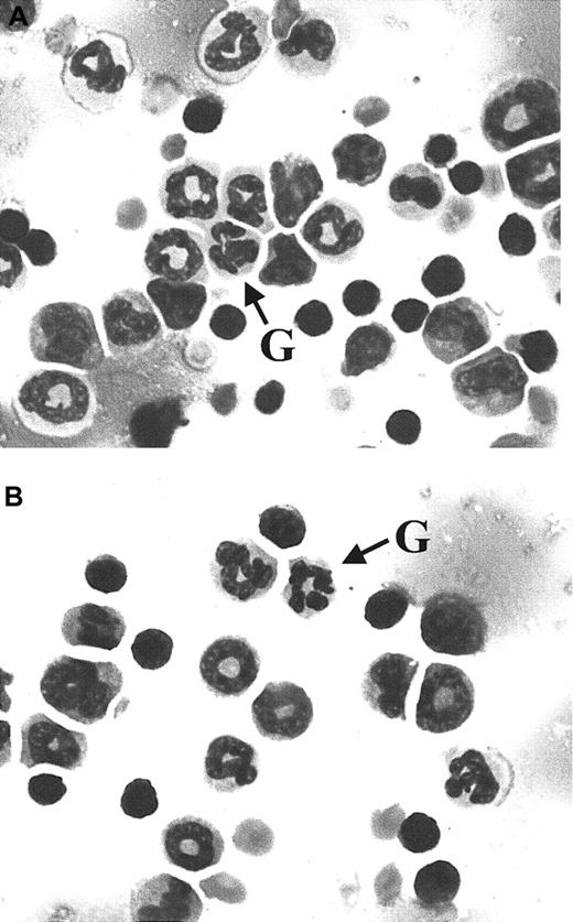Fig. 1. Wright-Giemsa–stained bone marrow cells from wild-type and C/EBPβ knockin mice. / Bone marrow smears from wild-type (A) andC/ebpαβ/β (B) mice show maturation of the myeloid lineage to mature granulocytes (indicated by G). Magnification × 100.