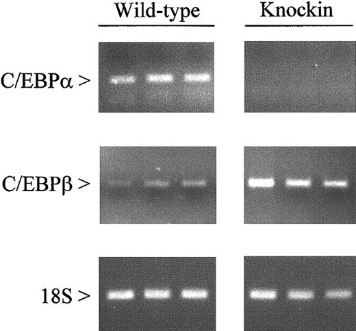 Fig. 2. Expression of C/EBPα and C/EBPβ messenger RNAs in wild-type and C/EBPβ knockin mice. / Gene expression was measured by RT-PCR using RNA from the bone marrow of wild-type and C/EBPβ knockin mice. After 35 (C/EBPα and C/EBPβ) and 15 (18S) cycles, amplification products were gel separated and stained with ethidium bromide.