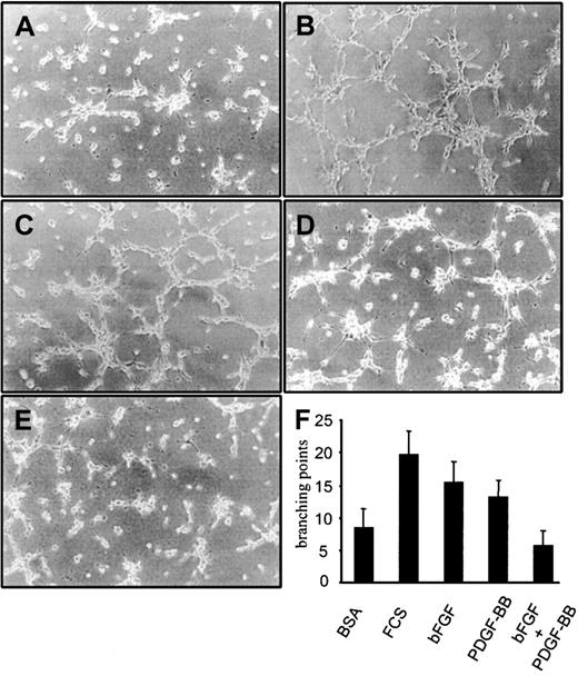 Fig. 3. BAEC differentiation into tubular structures on Matrigel. / BAEC differentiation on Matrigel-coated wells in the presence of (A) 0.1% BSA, (B) 1% FCS, (C) 10 ng/mL bFGF, (D) 10 ng/mL PDGF-BB, or (E) 10 ng/mL bFGF/PDGF-BB. (F) Quantification of branching points was carried out on 10 fields. The differentiation effect of bFGF was lowered to control levels in the presence of PDGF-BB. This effect was evident at 3, 6, 8, and 24 hours. Figures and the bar graph refer to the effect at 3 hours. Experiments were carried out 3 times in duplicate. Panels A to E refer to a representative experiment.