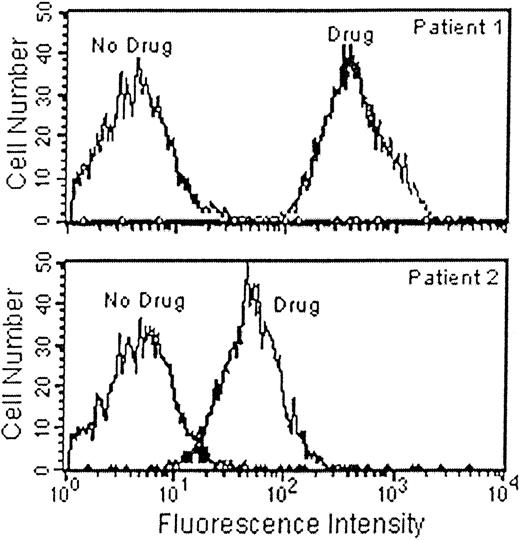 Fig. 1. Reactions of patient sera against platelets sensitized with abciximab. / The strong IgG antibody from patient no. 1 (A) and the weaker one from patient no. 2 (B) reacted with abciximab-coated platelets but not with uncoated platelets.