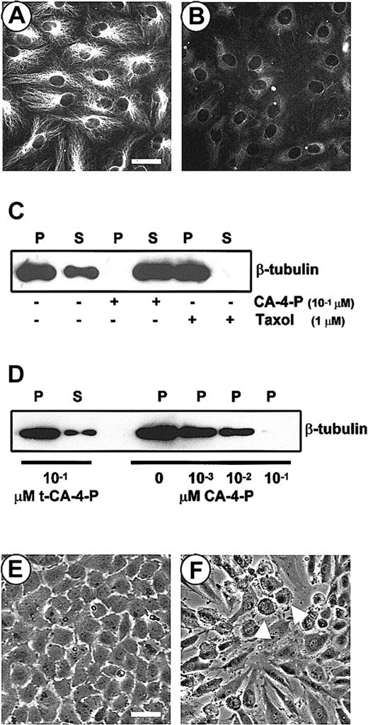 Fig. 1. CA-4-P disrupts the endothelial microtubule cytoskeleton and alters endothelial cell morphology. / (A,B) Immunostaining of endothelial cells with an anti–β-tubulin antibody before (A) and after (B) exposure to CA-4-P (1 μM, 30 minutes). Bar = 60 μm. (C,D) Western blotting analysis of soluble (S) and polymeric (P) tubulin fractions. Cells were exposed to either CA-4-P (30 minutes) or Taxol (30 minutes; C) or t-CA-4-P (30 minutes) or indicated amounts of CA-4-P (30 minutes; D). Equal aliquots of protein (30 μL) were run into the gel. (E,F) Phase contrast images of endothelial cells before (E) or after (F) exposure to CA-4-P (1 μM, 30 minutes). Arrowheads indicate blebbing cells. Bar = 90 μm.