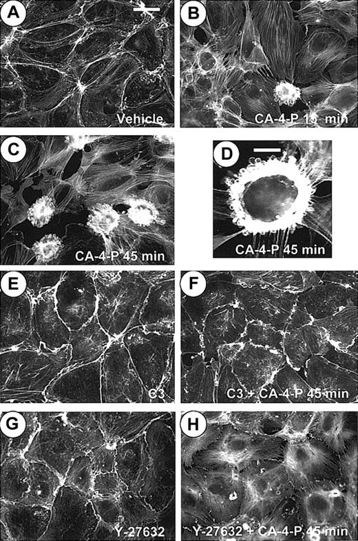 Fig. 3. CA-4-P stimulates early membrane blebbing in confluent endothelial cells by Rho/Rho-kinase. / Confluent endothelial cultures were pretreated with either vehicle control (A-D) or C3 exoenzyme (24 hours, 10 μg/mL; E,F) or Y-27632 (30 minutes, 10 μM; G,H) and then were exposed to 1 μM CA-4-P for either 15 minutes (B) or 45 minutes (C,D,F,H). Actin was stained with Texas Red–conjugated phalloidin as described in “Materials and methods,” and cells were examined by fluorescence microscopy. Bars for panels A-C and panels E-H = 40 μm. Panel D represents a higher magnification of a characteristic blebbing cell. Bar for panel D = 15 μm.