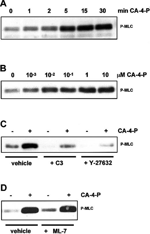 Fig. 8. CA-4-P activates MLC phosphorylation via Rho-kinase. / (A,B) Confluent endothelial cells were exposed to 1 μM CA-4-P (A) or 30 minutes CA-4-P (B). Cells in panels C and D were preincubated with vehicle, C3 exoenzyme (24 hours, 10 μg/mL), Y-27632 (30 minutes, 10 μM), or ML-7 (30 minutes, 10 μM) before exposure to CA-4-P (30 minutes, 1 μM). Equal amounts of cell proteins (30 μg) were analyzed by Western blotting for di-phosphorylated MLC (P-MLC).