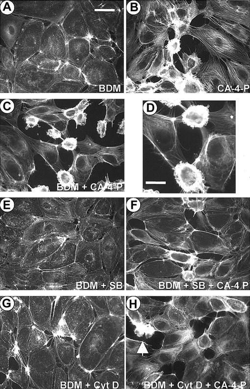 Fig. 9. Inhibition of myosin ATPase blocks contractility and up-regulates blebbing. / Confluent endothelial cells were preincubated with either vehicle control (DMSO; B) or BDM (5 mM, 30 minutes; A,C-H). In panels E and F, cells were preincubated with SB203580 (10 μM, 30 minutes) together with BDM and in panels G and H with cytochalasin D (10 nM, 30 minutes) together with BDM. Then cells were exposed to CA-4-P (1 μM, 60 minutes; B,C,D,F,H) and fixed and stained with Texas Red phalloidin. Panel D represents a higher magnification of cells in panel C. Bar for panels A-C and panels E-F = 42 μm; bar for panel D = 25 μm.