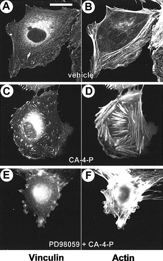 Fig. 10. CA-4-P induces the assembly of focal adhesions. / Sparse endothelial cells grown on Permanox slides were exposed to CA-4-P (60 minutes, 1 μM). Cells in panels E and F were pretreated with PD98059 (30 minutes, 25 μM) to induce blebbing. Cells were fixed and double stained with Texas Red phalloidin and antivinculin antibody. Panels A,C,E have vinculin staining; panels B,D,F, actin staining. Bar = 20 μm.