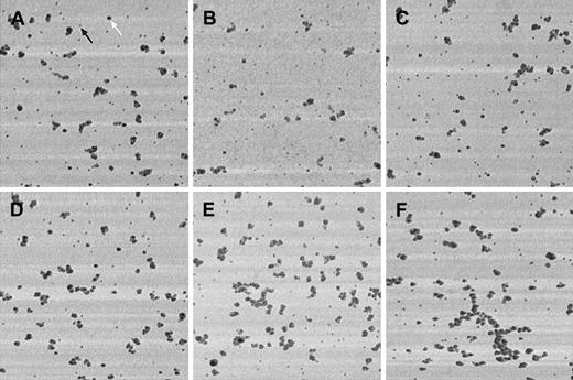 Fig. 2. Shear-dependent morphology of VWF adsorbed onto collagen. / PBS containing 1 μg/mL VWF was perfused at 0.07 N/m2(A-C) or at 4.55 N/m2 (D-F) shear stress for 5 minutes over calf skin collagen-coated coverslips. No morphologic differences are apparent between the samples obtained at low or at high shear regimes. Double labeling with 15-nm and 30-nm gold-conjugated protein A (the black arrow points at a 15-nm gold bead, the white arrow shows a 30-nm gold particle). Tapping-mode AFM, Microlever “F” tip, F = 118 kHz, setpoint is approximately 90% of the free vibration amplitude. Image dimensions: 5 × 5-μm lateral and 40-nm height range.