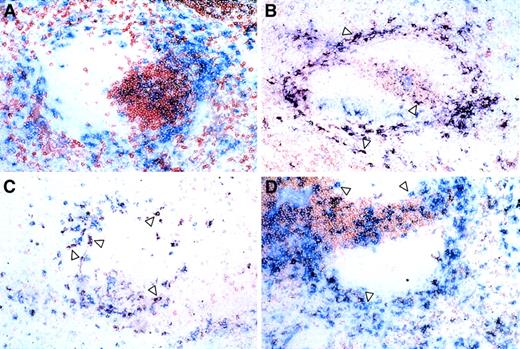 Fig. 5. Anatomic distribution of DC subsets. / Frozen spleen sections were processed for double labeling as described in “Materials and methods.” Blue (Fast Blue) = CD11c, and the indicated markers are shown in red (AEC). Double-labeled cells are purple: (A) Thy 1.2, (B) CD4 (arrows indicate CD11c+/CD4+ cells), (C) CD8 (arrows indicate CD11c+/CD8+ cells), and (D) CD4 and CD8 combination (arrows indicate CD11c+/CD4−/CD8− cells). Asterisks indicate periarteriolar lymphoid sheath.
