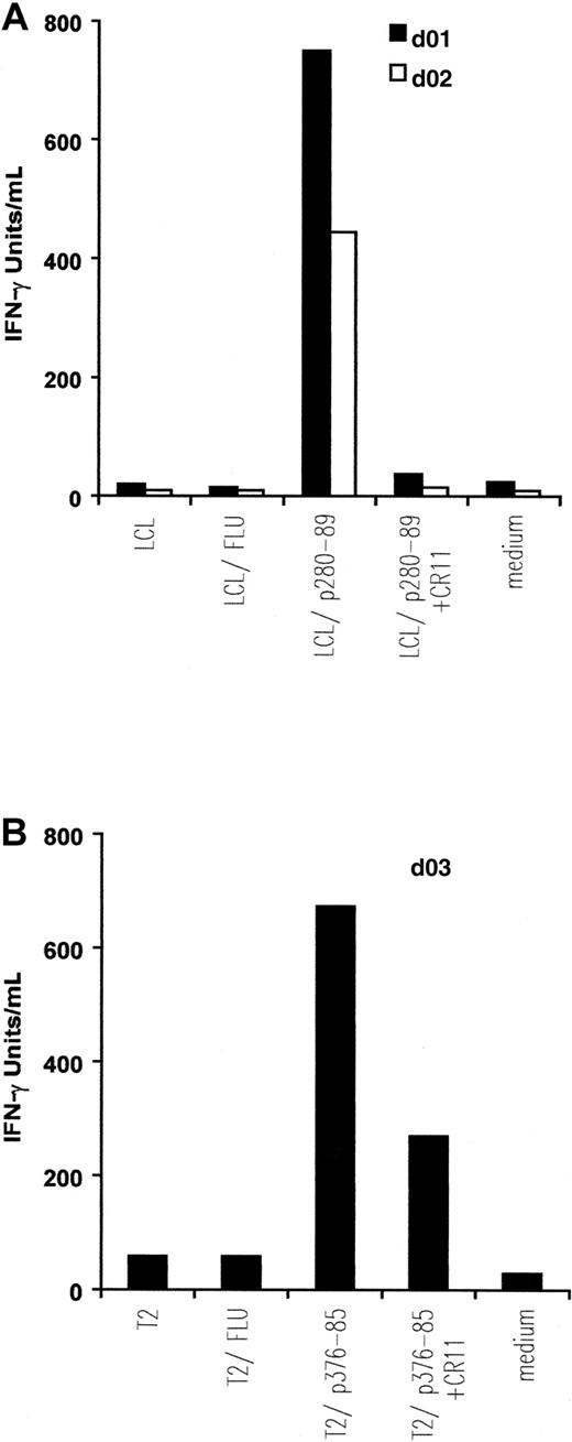 Fig. 2. IFN-γ release by in vitro–induced anti-ALK CTL lines. / Autologous EBV-transformed B cells (LCL) (A) and T2 cells (B) were pulsed with 5 μM, respectively, p280-89 and p376-85 peptides as well as influenza matrix peptide (FLU: irrelevant peptide) and were then used as stimulator in an IFN-γ release assay. Preincubation with 5 μg/mL anti-HLA-A2 mAb CR11.351 inhibits IFN-γ secretion. Results of 1 representative experiment of at least 3 performed are shown.