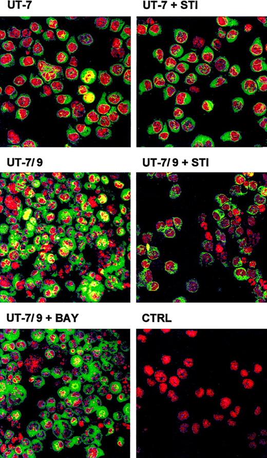 Fig. 6. STI571 modulates the activation of NF-κB in UT-7/9 cells. / Confocal microscopy analyses of nuclear localization of NF-κB p65 subunit (green) in UT-7/9 and UT-7 cells in basal condition and treated for 48 hours by STI571. Yellow staining indicates nuclear localization of NF-κB p65 subunit. As control UT-7/9 cells were treated for 16 hours by BAY 11-7082 (a specific inhibitor of NF-κB) before staining. CTRL correspond to nuclear (red) staining by propidium iodide (2 μg/mL) of UT-7/9 cells.