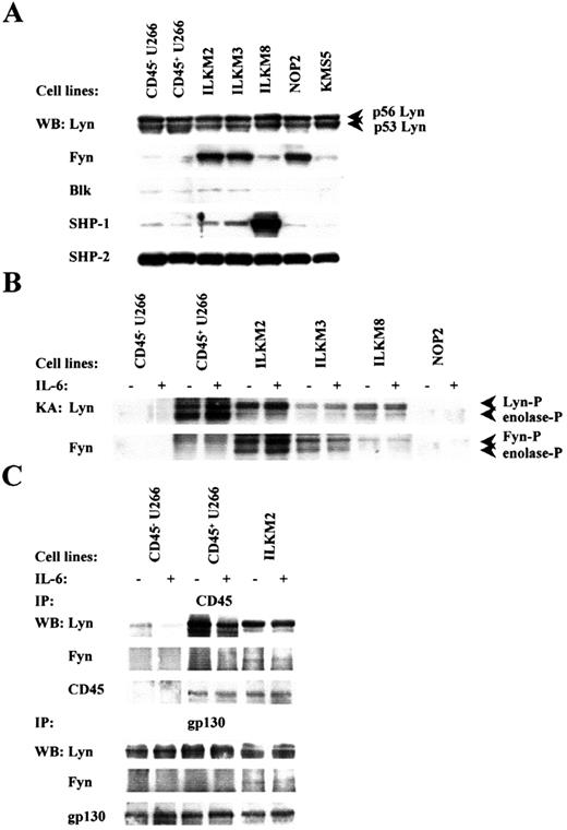 Fig. 3. src family PTKs are activated in CD45+ but not CD45− myeloma cell lines. / (A) Western blot analysis shows the expression of Lyn (p53 and p56), Fyn, Blk, SHP-1, and SHP-2 in the myeloma cell lines indicated. (B) The kinase activity of Lyn or Fyn in myeloma cell lines stimulated with (+) or without (−) IL-6 was investigated by kinase assay using enolase as an exogenous substrate. (C) The immunoprecipitation (IP) and Western blot analysis with the indicated antibodies were used to examine the interaction of Lyn or Fyn kinases with CD45 or gp130 molecules in myeloma cell lines treated with (+) or without (−) IL-6.