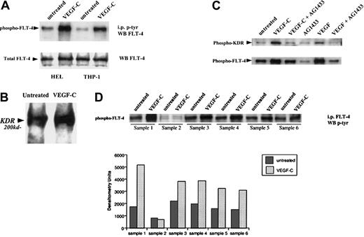 Fig. 2. VEGF-C induces FLT-4 phosphorylation on HEL and THP-1 cells. / (A) Serum-starved leukemic cells were left untreated or stimulated with VEGF-C (100 ng/mL) for 10 minutes and then immunoprecipitated for tyrosine-phosphorylated proteins. Subsequent blots were probed with antibody against FLT-4. As a control, total FLT-4 levels are also shown (FLT-4 Western blot). (B) HEL cells placed in serum-free conditions were treated in the absence or presence of VEGF-C (100 ng/mL) for 10 minutes and then lysed with RIPA buffer. Lysates were immunoprecipitated for FLT-4, and blots were probed with anti-KDR antibodies. (C) HEL cells placed in serum-free conditions were treated in the absence or presence of AG1433 (2 μg/mL) for 1 hour and then treated with VEGF-C (100 ng/mL) or VEGF (20 ng/mL) for 10 minutes. Cells were then lysed with RIPA buffer and lysates immunoprecipitated for tyrosine-phosphorylated proteins. Subsequent blots were probed with anti-KDR or anti–FLT-4 antibodies. (D) Six primary leukemias were left untreated or stimulated with VEGF-C (100 ng/mL) for 10 minutes, immunoprecipitated for FLT-4, and probed with an antibody for phosphorylated proteins. As shown, FLT-4 induced tyrosine phosphorylation in FLT-4+ samples (nos. 1, 3, 4, 5, and 6). Bar graph represents the densitometry quantification of phosphorylated FLT-4 and is representative of 3 independent experiments.