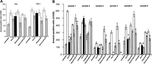 Fig. 5. Partial rescue of leukemic cells from chemotherapy-induced death. / (A) HEL and THP-1 cells (1 × 106 per well) were exposed to different chemotherapy agents (Ara-C, 200 ng/mL; etoposide, 1 μM; daunorubicin, 200 ng/mL) for 48 hours, and the number of apoptotic cells was determined by annexin V staining, as described in “Materials and methods.” In some conditions, cells were pretreated with 100 ng/mL VEGF-C, mutVEGF-C, or VEGF (100 ng/mL) for 24 hours, before addition of the chemotherapeutic agents. The cytokines, as with the chemotherapeutic agent, were readded to the cultures daily. As shown, VEGF-C and mutVEGF-C exerted a significant protective effect against the 3 agents used in this study. VEGF also protected HEL cells from Ara-C–induced apoptosis. Results shown were obtained from 3 independent experiments, and each condition was assayed in triplicate. *P < .05 (significant difference compared with chemotherapeutic agent alone)., indicates untreated; □, chemotherapy;, chemotherapy + VEGF-C; ■, Arg-C+VEGF. (B) Similar to the cell lines, 6 primary leukemia samples were cultured in serum-free conditions for 48 hours in the presence of different chemotherapeutic agents (Ara-C, etoposide, daunorubicin). In some conditions the cells were pretreated with VEGF-C (100 ng/mL) or mutVEGF-C (200 ng/mL) for 24 hours, prior to the addition of the chemotherapeutic agent. In these conditions, the cells received cytokines plus chemotherapeutic agent daily. Apoptotic cells were determined by annexin V staining, as described in “Materials and methods.” As shown, VEGF-C and mutVEGF-C protected FLT-4+ primary cells from chemotherapy-induced apoptosis (samples1, 3, 4, 5, and 6). Importantly, neither VEGF-C nor mutVEGF-C protected a FLT-4− sample (number 2) from chemotherapy-induced apoptosis. Results shown were obtained from 3 independent experiments, and each condition was assayed in triplicate. *P < .05 (significant difference compared with chemotherapeutic agent alone). nd: due to sample constraints, some conditions could not be assayed in triplicate and were therefore removed from the final graph., indicates untreated; □, chemotherapy;, chemotherapy + VEGF-C; ■, Arg-C+mutVEGF-C.