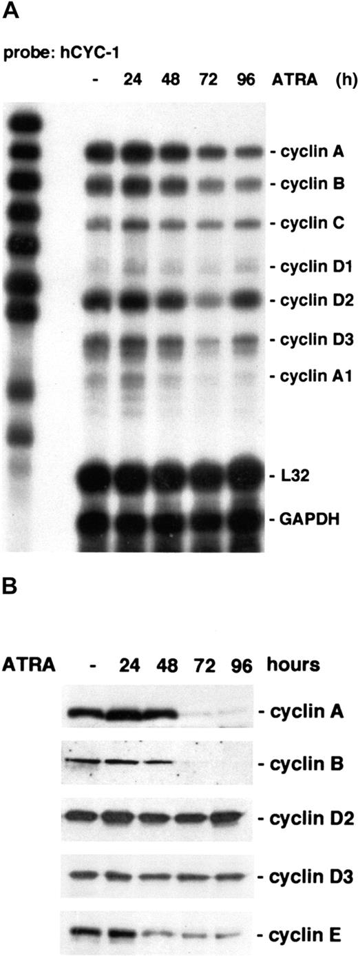 Fig. 2. Cyclins A, B, D3, and E are down-regulated during ATRA-induced differentiation of U-937 cells. / (A) Cells were induced by ATRA and harvested at the indicated times, and total mRNA was prepared. The regulation of cyclin mRNA during ATRA treatment was analyzed by RPA using the hCYC-1 multiprobe template. (B) The protein levels of cyclins A, B, D2, D3, and E during ATRA-induced differentiation were determined by Western blot analysis using whole cell lysates.