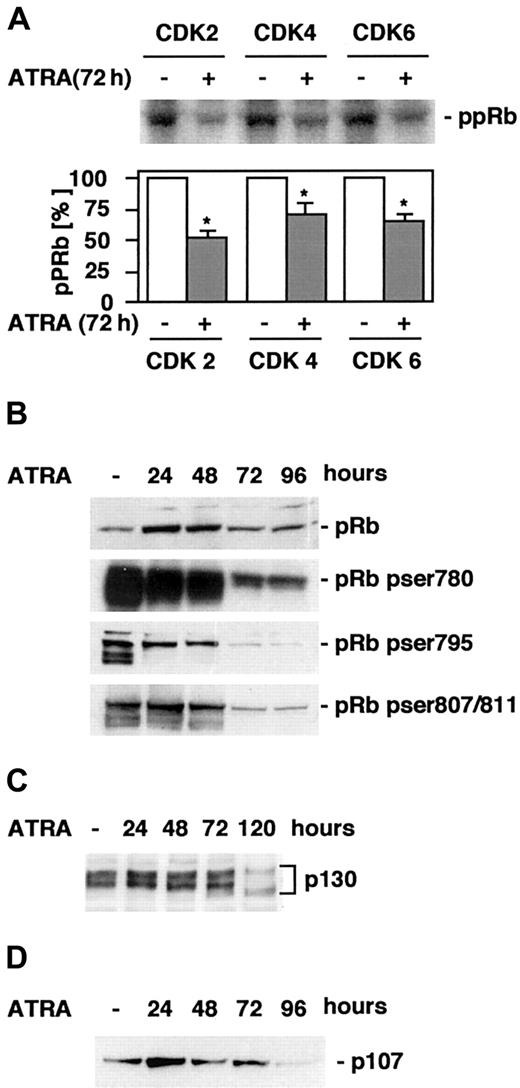 Fig. 4. ATRA treatment of U-937 cells results in decreased CDK activity and a reduction in hyperphosphorylated pRb. / (A) CDK2, 4, and 6 kinase activity was measured in an in vitro kinase assay using pRb as a substrate. Cells were grown in the presence or absence of ATRA for 72 hours, whole cell lysates were prepared, and the activities of CDK2, CDK4, and CDK6 were determined as described in “Materials and methods.” The graph indicates quantification of the bands correlated to control. Mean ± SD (n = 4). The asterisk indicates significant differences from the corresponding controls (P < .05). (B-D) The levels of total pRb or Ser780, Ser795, or Ser807/811 phosphorylated pRb (B), p130 (C), or p107 (D) during ATRA-induced differentiation were determined by Western blot of whole cell lysates prepared at the indicated times using specific antibodies.