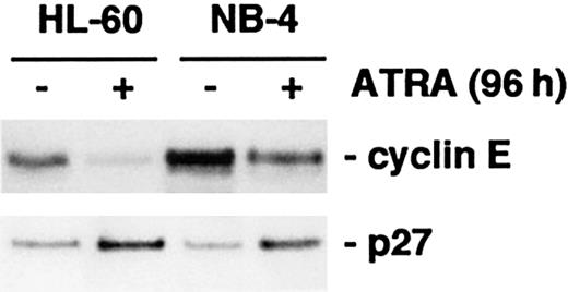 Fig. 5. HL-60 and NB-4 cells respond to ATRA treatment by down-regulation of cyclin E and up-regulation of p27. / Cells were induced by ATRA for 96 hours, whole cell lysates were prepared, and the protein levels of cyclin E and p27 were analyzed by Western blot.