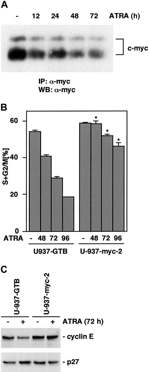 Fig. 6. Exogenous expression of Myc inhibits ATRA-induced cell cycle arrest and the associated down-regulation of cyclin E and up-regulation of p27. / (A) The expression of c-Myc is down-regulated in response to ATRA treatment in U-937 cells. Cells were treated with ATRA for 0, 12, 24, 48, and 72 hours as indicated; whole cell lysates were prepared and subjected to immunoprecipitation using pan-Myc antibodies. The immunocomplexes were collected, separated by SDS-PAGE, and analyzed by Western blot using biotin-coupled pan-Myc antibodies and streptavidin-HRP. (B) U-937-myc-2 cells and the parental subline U-937-GTB were grown in the presence of ATRA, collected at the indicated times, and the distribution of cells in different cell cycle phases was determined by flow cytometry of PI-stained nuclei. Mean ± SD (n = 3). The asterisk indicates significant differences from the corresponding U-937-GTB controls. (C) The protein levels of cyclin E and p27 after 72 hours of ATRA treatment in U-937-GTB and U-937-myc-2 cells were analyzed by Western blot.