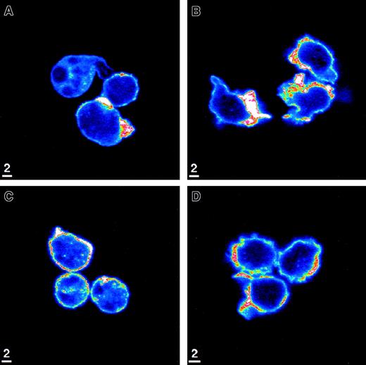 Fig. 4. Representative images from confocal microscopy using rhodamine-phalloidin to delineate F-actin. / Neutrophils isolated from circulating blood (A) were spherical, and the small amount of F-actin was located within the central regions of these cells. Occasional neutrophils showed pseudopod formation and contained F-actin within these pseudopods. On stimulation with fMLP (B), their shape became markedly distorted, with numerous pseudopods and irregularities to the plasma membrane. F-actin was no longer observed within the central regions of the neutrophils. Increased amounts of F-actin were present in the submembrane region, forming a shell beneath the membrane. Quiescent neutrophils isolated from the BM (C) were spherical. The amount of F-actin was greater than in the quiescent neutrophils isolated from the circulating blood. Although these cells contained a small amount of F-actin in the central regions, similar to the circulating neutrophils, the increase in F-actin was located primarily in the submembrane region. Stimulation of BM neutrophils with fMLP (D) induced only small changes in shape that were minimal compared with those observed in the circulating blood. As in the circulating neutrophils, the BM neutrophils showed a marked increase in F-actin within the submembrane region and no identifiable F-actin within the central region. n = 3 rats in each group.