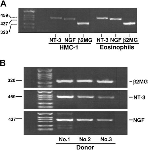Fig. 1. RT-PCR analysis of eosinophil neurotrophin gene expression. / (A) Total mRNA was extracted from 2 × 106 freshly isolated eosinophils or cultured HMC-1 cells. The RNA was reverse transcribed to complementary DNA and amplified with specific primers for NGF, NT-3, or β2-MG. A 35-cycle PCR was performed. The products were electrophoresed on a 3% agarose gel followed by staining with ethidium bromide. (B) The experiments were repeated 3 times using eosinophil preparations from 3 different donors. Amplified complementary DNA bands are compatible with the size of estimated PCR products for NGF (437 bp), NT-3 (459 bp), and β2-MG (positive control, 320 bp).