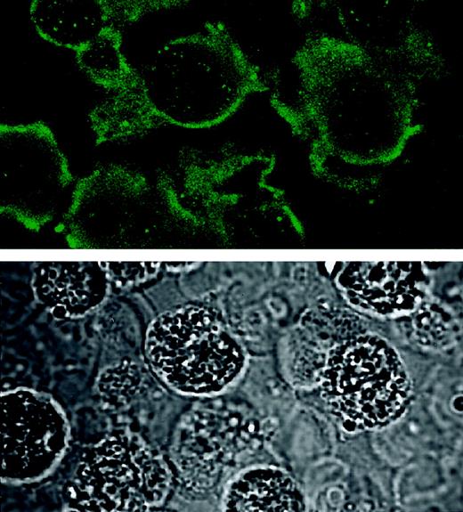 Fig. 2. Immunocytochemistry for NGF in eosinophil sections. / Freshly isolated eosinophils were collected and mixed with 1% agar and embedded in paraffin. Five-micrometer sections were blocked with normal rabbit serum and incubated with goat antihuman NGF antibody, followed by additional blocking with chromotrope 2R. Bound antibody was then visualized by affinity-purified FITC-conjugated rabbit antigoat IgG. The fluorescence images (upper panel) were captured with a confocal laser-scanning microscope. Transmission images (lower panel) were also captured from the same field to visualize the morphology of the cells. Note that the fluorescence image is captured from an approximately 1-μm optical section and that the transmission image is from a whole 5-μm section. Original magnification × 600.