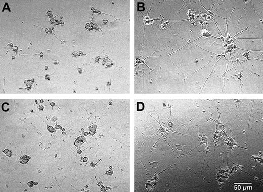 Fig. 4. Supernatants from activated eosinophils promote elongation of neurites in PC-12 cells. / Eosinophils were suspended in RPMI 1640 medium supplemented with 10% DCS and incubated with medium alone or sIgA (20 μg/mL) and antihuman sIgA monoclonal antibody (1:10 000) plus 25 ng/mL IL-5 for 24 hours at 37°C. After culture, cell-free supernatants were collected. PC-12 cells were incubated with medium alone (A), 2 ng/mL NGF (B), supernatant of eosinophils cultured with medium alone (C), or supernatant of eosinophils cultured with sIgA immune complex and IL-5 (D) for 24 hours. The cell morphology was examined under the inverted microscope. Bar = 50 μm. Original magnification × 100.