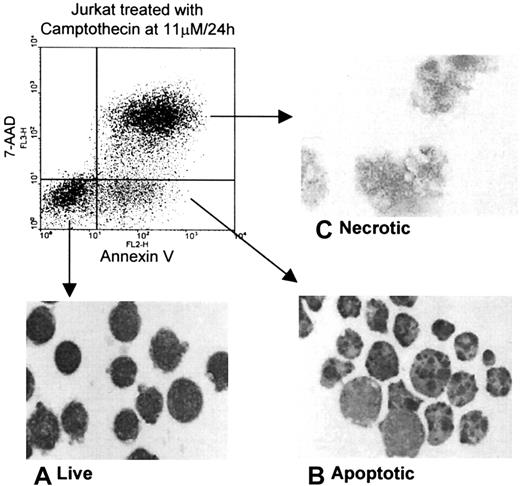 Fig. 1. Morphology of each population of live, apoptotic, and necrotic Jurkat cells after separation by cell sorting. / Jurkat cells (1 × 107) were treated with Camptothecin for 24 hours and were separated according to the binding of PE–annexin V and the uptake of 7-AAD into live, apoptotic, and necrotic populations by cell sorting using a FACSVantage machine and were stained with Giemsa-May-Grünwald. Typical morphology of each population was determined by light microscopy, as shown in the insets: (A) live cells with intact membrane and a rim of cytoplasm; (B) apoptotic cells with characteristic apoptotic bodies; (C) necrotic cells with swollen organelles and loss of a discrete cell membrane.