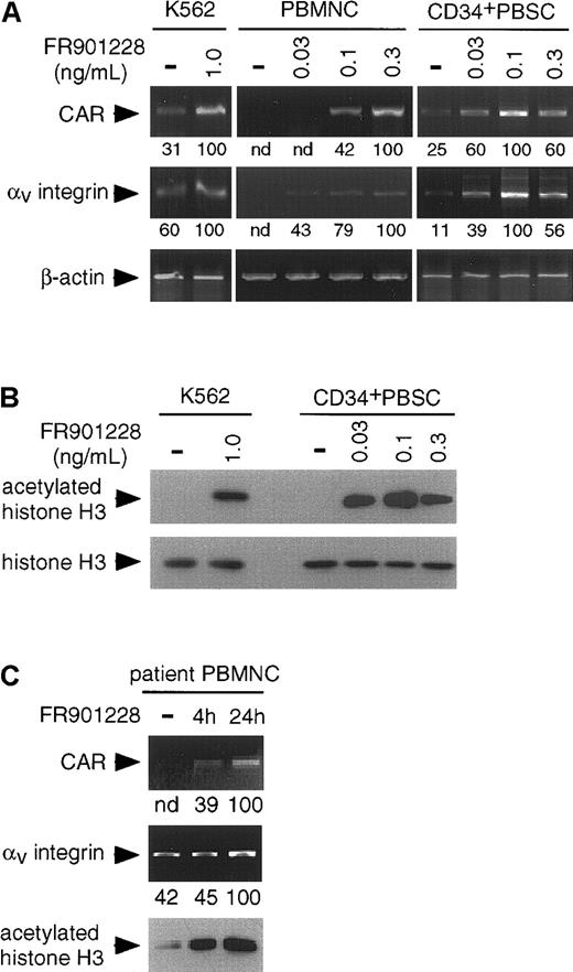 Fig. 1. Effects of FR901228 treatment on hematopoietic cells by RT-PCR and Western blot analyses. / (A) RT-PCR analysis of CAR and αv integrin RNA levels in FR901228-treated cells. K562 cells were incubated without (−) and with the indicated concentrations of FR901228 for 72 hours before the isolation of RNA. Frozen PBMCs and CD34+ PBSCs were thawed and expanded in medium for 4 days and then treated without (−) and with the indicated concentrations of FR901228 for 24 hours before isolation of RNA. RNA was isolated, and RT-PCR was performed as previously described25 using β-actin as the loading control. For quantitation, which is shown below the photographs, the density of the bands was determined by densitometry, the brightest was set to a value of 100, and the lighter bands were normalized to it. nd indicates not detectable. (B) Western blot analysis of FR901228-treated cells. K562 cells or CD34+ PBSCs were incubated without (−) or with the indicated concentrations of FR901228. K562 cells were treated for 48 hours, and CD34+ PBSCs were treated for 24 hours. Total cellular protein was isolated, and Western blot analysis was performed as previously described.25 Histone H3 functions as the loading control. (C) RT-PCR and Western blot analyses of PBMCs from a patient treated with FR901228. RNA and protein were isolated from PBMCs from a patient receiving FR901228 on our phase 1 trial. Time points are before the start of drug infusion (−), at the end of the 4-hour infusion, and after 24 hours. Quantitation, which is shown below the photographs, is as described above. nd indicates not detectable