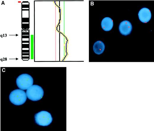 Fig. 2. Demonstration of partial trisomy 3 in the PBMCs of the index case. / (A) CGH. Partial profile of chromosome 3 showing the region of duplication involving the long(q) arm. Chromosomal regions were considered overrepresented when the corresponding green-to-red ratio exceeded 1:18 and underrepresented when the ratio was below 0:83. Thresholds were fixed on profiles obtained from hybridization of 2 differently labeled normal DNAs extracted from healthy donors. Telomeric and centromeric regions as well as heterochromatic regions of chromosome 1, 9, 16, and Y were excluded from analysis, because of possibly false-positive results. Results were confirmed by means of a 99% confidence interval, with 1% error probability. (B) Interphase FISH with probe for centromeric sequences of chromosome 3 showing only disomic nuclei. Signals were evaluated on 600 interphase cells, of which 2.6% showed 1 spot; 97.1%, 2 spots; and 0.3%, 3 spots. (C) Interphase FISH with the locus-specific probe for MLF1 gene (3q25) showing 3 spots in 3 of 4 nuclei. Signals were evaluated in 100 interphase cells, of which 20% showed 2 spots and 80% showed 3 spots.