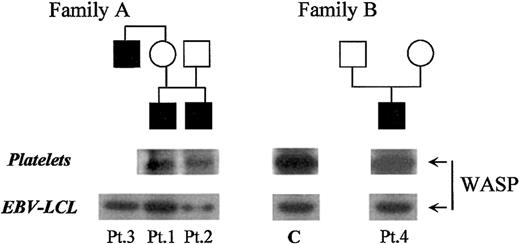Fig. 2. Analysis of WASP protein expression in 4 males with intermittent X-linked thrombocytopenia. / (top) Pedigrees of the 2 families with intermittent X-linked thrombocytopenia. (bottom) Western-blot analysis of WASP protein expression in platelets and in Epstein-Barr virus–transformed lymphoblastoid B cell lines (LCL) derived from the patients and from a normal control (C).