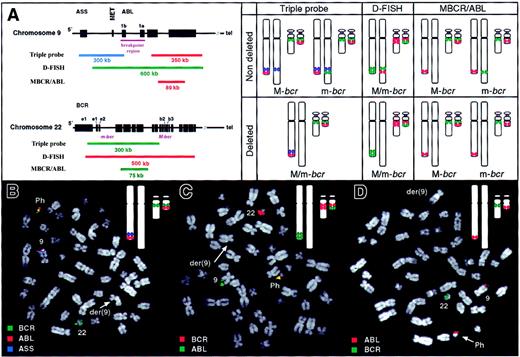 Fig. 1. FISH analysis of bone marrow metaphases from Ph-positive ALL patients. / (A) Structure of ABL and BCR genes with composition of the indicated probe systems together with expected hybridization patterns using all 3 probe systems on Ph-positive metaphases. Chromosome 9 homologues are shown on left (normal 9 and derivative 9, respectively) while chromosome 22 homologues are shown on right (normal 22 and Ph, respectively). (B-D) FISH analysis of Ph-positive bone marrow metaphases from ALL patient with deletion of derivative chromosome 9. Each panel shows a metaphase together with an image of the expected hybridization signals (inset). (B) Triple-probe analysis. The blue ASS signal is absent from the derivative chromosome 9 indicating a deletion of chromosome 9 sequences from this chromosome. (C) D-FISH analysis with absence of colocalized signal on der(9) revealing deletion of 9q and 22q sequences from this chromosome. (D) MBCR/ABL analysis. Lack of a BCR signal on the Ph chromosome indicates an m-bcr breakpoint. This signal does not appear on the derivative chromosome 9 consistent with a deletion of this region. Images were captured using an epifluorescence microscope (Axioplan 2, Zeiss, United Kingdom), and SmartCapture 2001 software (Digital Scientific, United Kingdom).
