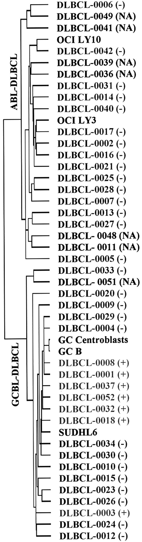 Fig. 2. Dendrogram showing the distribution of t(14;18)-positive cases of DLBCL (red). / This hierarchical clustering dendrogram was generated based on the genes in the GC B-cell gene expression signature previously described by Alizadeh et al.9 The positive and negative results of FISH for the t(14;18) are indicated as (+) or (−), whereas (NA) indicates that no material was available for FISH study.