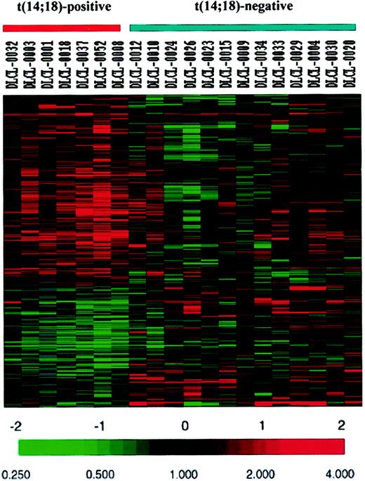 Fig. 4. Genes and ESTs represented by 403 clones showing differential expression between the t(14;18)-positive and t(14;18)-negative cases of GCBL-DLBCL. / Each horizontal row represents a separate cDNA clone on the microarray and each vertical column a separate case. The results are represented as the ratios of the hybridization signals on each spot on the microarray generated by the experimental mRNA samples versus the reference mRNA sample. These ratios are a measure of the relative gene expression of the experimental sample versus the reference standard and are depicted according to the color scale shown at the bottom. As indicated, the scale extends from a fluorescence ratio of 0.25 to 4 (−2 to +2 in log-base 2 units).