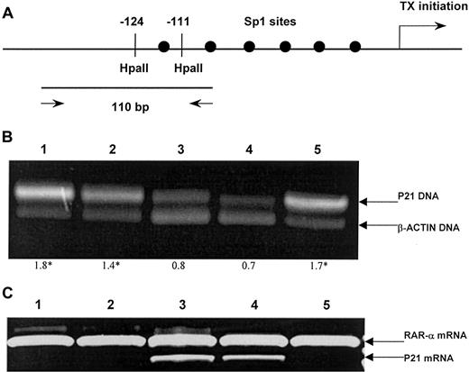 Fig. 1. Aberrant p21 methylation in acute lymphoblastic leukemia. / (A) A schematic map of the p21 promoter for restriction sites and the position of a primer set. Arrow indicates the location of the transcription initiation site of the p21 gene. Six Sp1-binding sites are located in a GC-rich region within 180 base pairs (bp) upstream of the transcription initiation site of the p21 gene. The −124 and −111 indicate the recognition sites of the restriction enzymeHpaII. Two arrows indicate a primer set for PCR and the size of PCR product, 110bp. (B) Methylation status of the p21 promoter region was detected by means of PCR of the HpaII-digested DNA. The upper band represents the 110-bp amplification product of the p21 gene, and the lower band, 75 bp of the β-actin gene. The optical density curves of both fragments were used to quantify the methylation level of p21 gene. The mean p21/β-actin ratio in normal bone marrow and the SE were used to assess p21 methylation state. Ratios above 3 SEs were considered hypermethylated. Lanes 1-5 show ALL samples. The p21–to–β-actin ratios are shown below the gel, with hypermethylated status indicated by asterisks. (C) Expression of p21 messenger RNA (mRNA) assessed by reverse-transcriptase (RT) PCR by means of primers for p21 and RARα (as control). Lanes 1, 2, and 5: hypermethylated ALL samples showing lack of p21 expression. Lanes 3, 4: normally methylated samples.