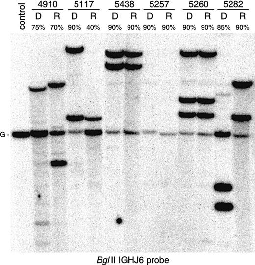 Fig. 1. Comparative Southern blot analysis of. / IGH gene configuration in 6 precursor-B–ALL patients. Monoclonal patients 5438 and 5260 (patient with trisomy 14) show identical gene rearrangements at diagnosis and at relapse. In monoclonal patient 5117, one allele at relapse is deleted and another one is preserved. Patient 5257 demonstrates biallelic IGHdeletion at both disease stages. Oligoclonal patient 4910 and monoclonal patient 5282 (the upper weak band in the diagnosis lane is derived from previous hybridization) show completely changedIGH gene rearrangement patterns. While sequence analysis has proven a clonal relationship between diagnosis and relapse in patient 4910, patient 5282 most likely represents a secondary ALL.