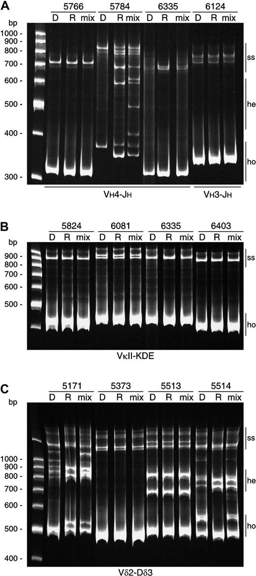 Fig. 2. Examples of comparative heteroduplex PCR analysis. / (A) Comparative heteroduplex analysis of IGH gene rearrangements. Monoclonal homoduplexes (ho) in patients 5766, 6335, and 6124 found at diagnosis and at relapse were of the same size. Mixing of the PCR products of these disease phases followed by heteroduplex PCR analysis demonstrated no heteroduplex (he) formation, proving that these gene rearrangements had identical junctional regions. In patient 5784, monoclonal homoduplexes found at diagnosis and at relapse slightly differed in size. Mixing of the VH4-JH PCR products followed by heteroduplex PCR analysis demonstrated clear heteroduplex formation, proving that these VH4-JHgene rearrangements had different junctional regions; (ss) indicates remaining single-strand fragments. (B) Comparative heteroduplex analysis of Kde rearrangements showed completely identical rearrangements at diagnosis and at relapse. (C) Comparative heteroduplex analysis of Vδ2-Dδ3 gene rearrangements. Patients 5373 and 5513 with monoallelic and biallelic rearrangements, respectively, had stable Vδ2-Dδ3 rearrangements. In contrast, Vδ2-Dδ3 joinings at diagnosis in patients 5171 and 5514 are oligoclonal, while in both cases 2 monoclonal Vδ2-Dδ3 rearrangements were found at relapse.