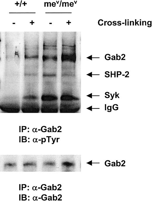 Fig. 7. The. / SHP1 gene mutation led to elevated tyrosine phosphorylation of the Syk kinase and the Gab2 docking protein.Bone marrow–derived macrophages from mev/mevand wild-type (+/+) mice were generated, starved, and stimulated by β1- integrin cross-linking as detailed in “Materials and methods.” Anti-Gab2 immunoprecipitation was conducted followed by antiphosphotyrosine Western blotting. The membrane was stripped and reprobed with anti-SHP-2, Syk, and Gab2 Abs. Shown in the figure is a representative of 2 independent experiments.