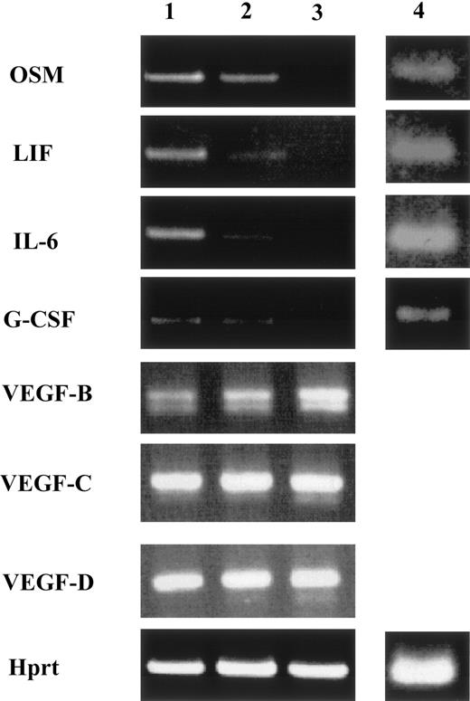 Fig. 2. Expression of hematopoietic cytokines and VEGFs inop/op AGM culture. / Floating cells were washed out with phosphate-buffered saline (−), and adherent cells in AGM culture were harvested for synthesis of ssDNAs. PCR was performed to examine the expression of hematopoietic cytokine using a specific set of primers. Lane 1, wild-type; lane 2,op/+; lane 3, op/op; lane 4,op/op + M-CSF.