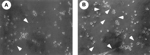 Fig. 8. Matrigel analysis of PCLP-1+CD45− cells incubated with or without M-CSF. / After coculture of PCLP-1+CD45− cells with or without M-CSF in the presence of bFGF and OSM, adherent cells were replated onto Matrigel, and the photograph was taken after 12 hours of incubation. Arrowheads indicate the sprouting of cell cytoplasm. Note that cellular networks are more frequently found in the culture of PCLP-1+CD45− cells that were incubated with OP9 stromal cells in the presence of M-CSF.