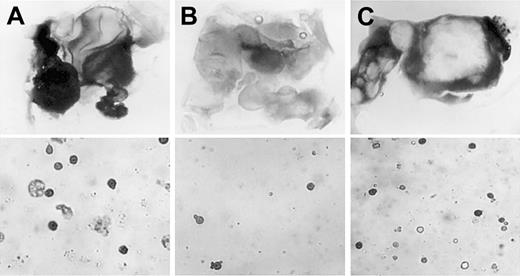 Fig. 7. Rescue of primitive erythropoiesis in VAD explants by exogenous BMP4. / Posterior nodal piece explants were taken at stage 4 from normal (A) or VAD (B, C) embryos and were cultured either alone (A, B) or in the presence of 2.5 μg/mL recombinant purified BMP4 (C). Shown are representative photographs of explants that were stained in whole-mount preparations using benzidine (top panels, dark stain indicates erythroid cells; original magnification × 32.) or in cytospin preparations from explants that were first dissociated and then stained with benzidine (lower panels, original magnification × 200.). With whole-mount staining, large benzidine-positive regions were identified in 93% of the normal explants (n = 15), 22% of the VAD explants (n = 9), or 76% of the VAD explants cultured with BMP4 (n = 21). The recovery of erythroid cell number is similarly reflected quantitatively by the cytospin preparations.