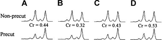 Fig. 3. X-inactivation ratios in bone marrow donor (D5) and fully engrafted recipient (R5) in the first year after HSCT. / Corrected HUMARA allelic ratios (Cr) in neutrophils were determined by dividing the allelic ratio of the precut sample by the allelic ratio of the non-precut sample of the same specimen. (A) Donor. (B) Recipient at the time of engraftment. (C) Recipient 6 months after HSCT. (D) Recipient 12 months after HSCT.