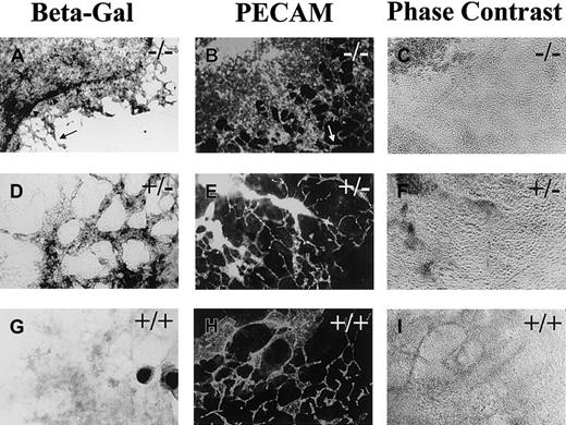 Fig. 1. Flt-1−/− ES cell cultures have increased vascularization. / Day 8 differentiated flt-1−/− (A-C),flt-1+/− (D-F), and WT (G-I) cultures were processed for β-galactosidase detection (A,D,G) or reacted with an antibody to PECAM (B,E,H). A and B show one quadrant of the relatively large β-galactosidase+ (A) or PECAM+ (B) sheet of cells that characterizes the flt-1−/−phenotype. In contrast, an extensive vascular plexus is found in bothflt-1+/− (E) and WT (H) ES cell cultures. Arrowheads (A) outline an intensely stained β-galactosidase+ ring of cells that surrounds most of the β-galactosidase+ cells. Arrows (A,B) point toflt-1−/− vasculature that looks WT. (C,F,I) Phase contrast images of PECAM-labeled fields in B,E,H. Magnification is ×10.