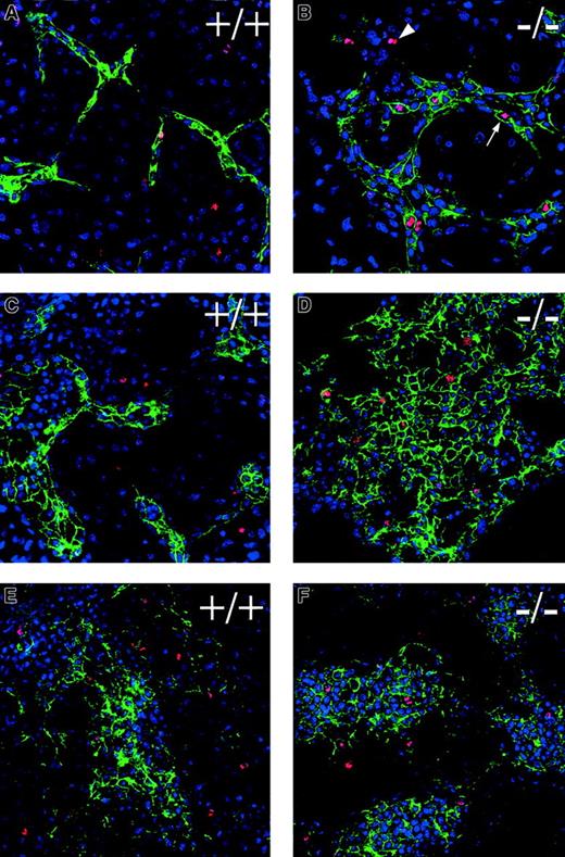 Fig. 3. Flt-1−/− ES cell cultures have mitotic endothelial cells. / Day 7 (A-D) or day 6 (E,F) WT (A,C,E), andflt-1−/− (B,D,F) attached cultures were labeled with antibodies to PECAM (green) and phosphohistone H3 (red), then stained with the nuclear marker topro-3 (blue). The arrowhead (B) shows a phosphohistone H3+ nonendothelial cell (PECAM−), whereas the arrow (B) points to a phosphohistone H3+ endothelial cell (PECAM+). Notice the increase in phosphohistone H3+/PECAM+ cells inflt-1−/− cultures relative to WT cultures. All panels are confocal images at ×40 magnification.