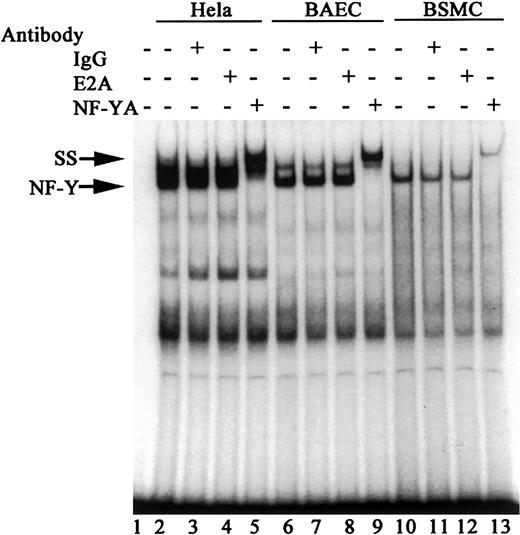 Fig. 3. Identification of NFY as a component of protein complex “R.”. / Nuclear extracts from HeLa, BAE, and BSMC cells (5 μg) were incubated with IgG antibody, anti-E2A, or anti-NF-YA antibodies (1 μg each) for 3 hours at 4°C prior to addition of the labeled probe. The probe used was the same as described in Figure 2. After addition of the labeled probe (10 000 cpm/reaction), reaction mixtures were incubated at room temperature for an additional 30 minutes and analyzed on a nondenaturing acrylamide gel as described in Figure 2. Lane 1 represents the probe alone with no nuclear extracts. Lanes 2 to 13 represent probe incubated with nuclear extracts in the presence (+) or absence (−) of each antibody. The positions of the NFY and supershifted complexes (shown as SS) are shown by the arrows. The figure shown is a representative of 2 independent experiments.