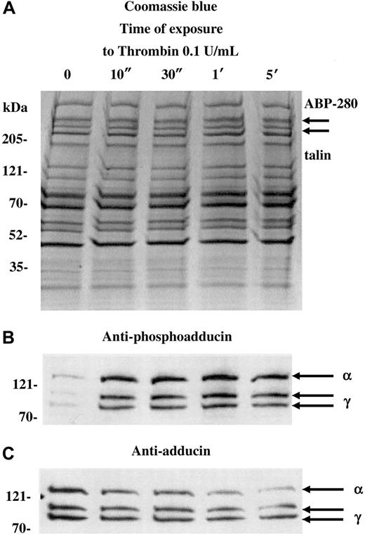 Fig. 1. PKC phosphorylation and proteolysis of adducin in thrombin-activated platelets. / Column-purified human platelets were exposed to dilute thrombin (0.1 U/mL) in the presence of 2.5 mM CaCl2 for 10 seconds to 5 minutes. (A) Coomassie blue–stained gel. (B) Western blotting with an antibody specific for the carboxy terminal PKC phosphorylation site of adducin demonstrated rapid phosphorylation of alpha and gamma adducins. Western blotting with a general anti-adducin antibody (C) demonstrated increasing proteolysis of adducin with time of exposure to thrombin.