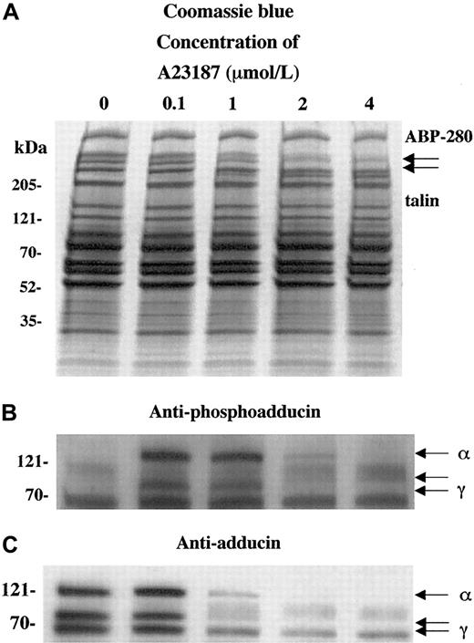Fig. 3. Activation of platelets with calcium ionophore A23187 (and 2.5 mM CaCl2) mimics the effect of thrombin on adducin phosphorylation and proteolysis. / Direct activation of PKC by influx of calcium ions caused PKC phosphorylation of adducin (B) as well as proteolysis (C). At low concentrations of ionophore, phosphorylation occurred without proteolysis (lane 2).