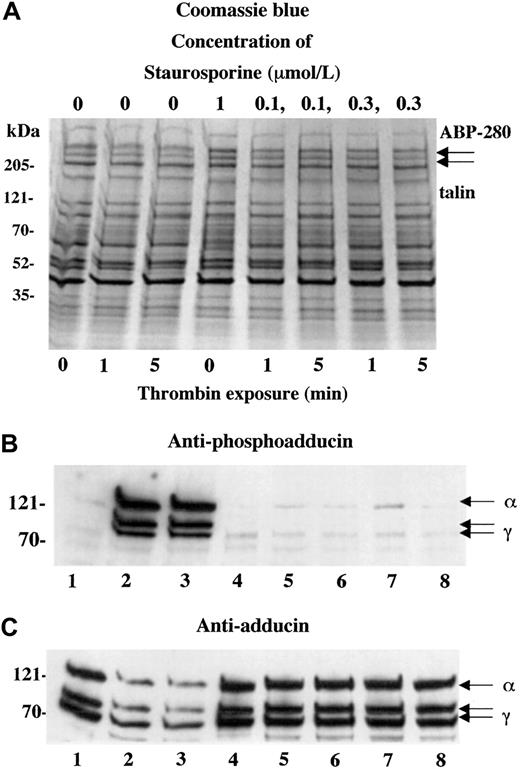 Fig. 5. Staurosporine blocked thrombin-induced PKC phosphorylation and proteolysis of adducin. / Preincubation of platelets with the kinase inhibitor staurosporine (10 minutes) completely blocked thrombin-induced PKC phosphorylation of adducin (B) and proteolysis (C). Thrombin concentration, 1 U/mL; CaCl2, 2.5 mM.