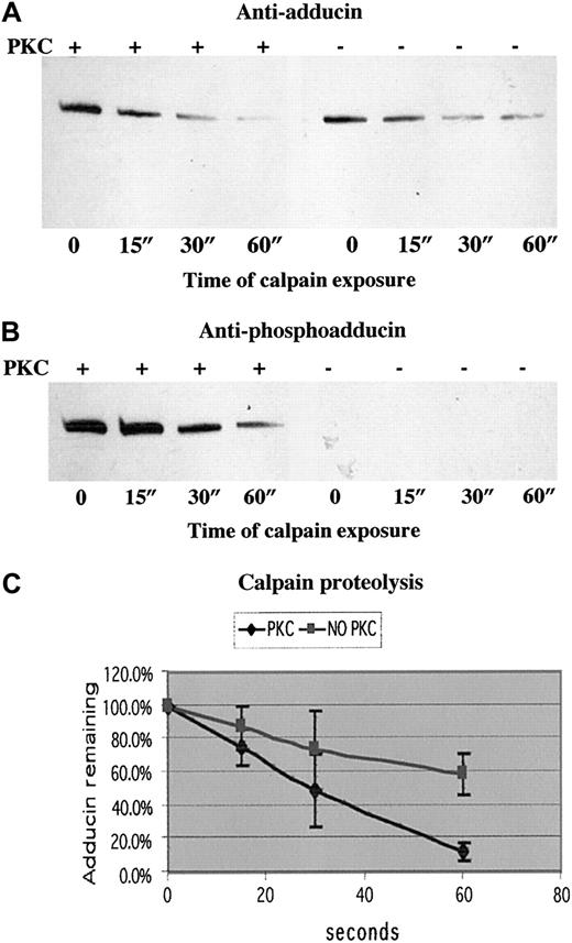 Fig. 7. PKC-phosphorylated adducin was proteolyzed more quickly than unphosphorylated adducin. / Western blotting with (A) anti-adducin antibody and (B) anti-phosphoadducin antibody from a typical time course of μ-calpain proteolysis of recombinant alpha adducin. In lanes 1 to 4, adducin was phosphorylated by PKC before addition of calpain. In lanes 5 to 8, reaction mix included everything as in lanes 1 to 4 except PKC. (C) Quantitation of density of bands from 3 experiments measured with NIH Image and converted to relative optical density. The slope of the line for proteolysis of PKC-phosphorylated adducin is significantly different (P < .001) from the slope of the line for proteolysis of unphosphorylated adducin.