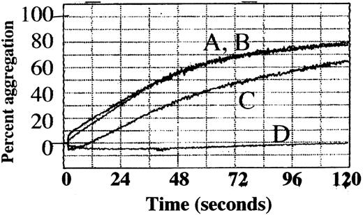 Fig. 9. Platelet aggregation was delayed by staurosporine and inhibited by calpeptin. / Column-purified platelets were stimulated with thrombin (1 U/mL) in the presence of 2.5 mM CaCl2, and the percentage of aggregation was followed as a measure of change in light transmission over 120 seconds. (A) Control, (B) 0.8% DMSO (vehicle), (C) 0.3 μM staurosporine 30 minutes preincubation, (D) 200 μg/mL calpeptin 30 minutes preincubation.